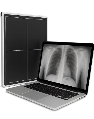 цифровой детектор и ноутбук для рентгенографии